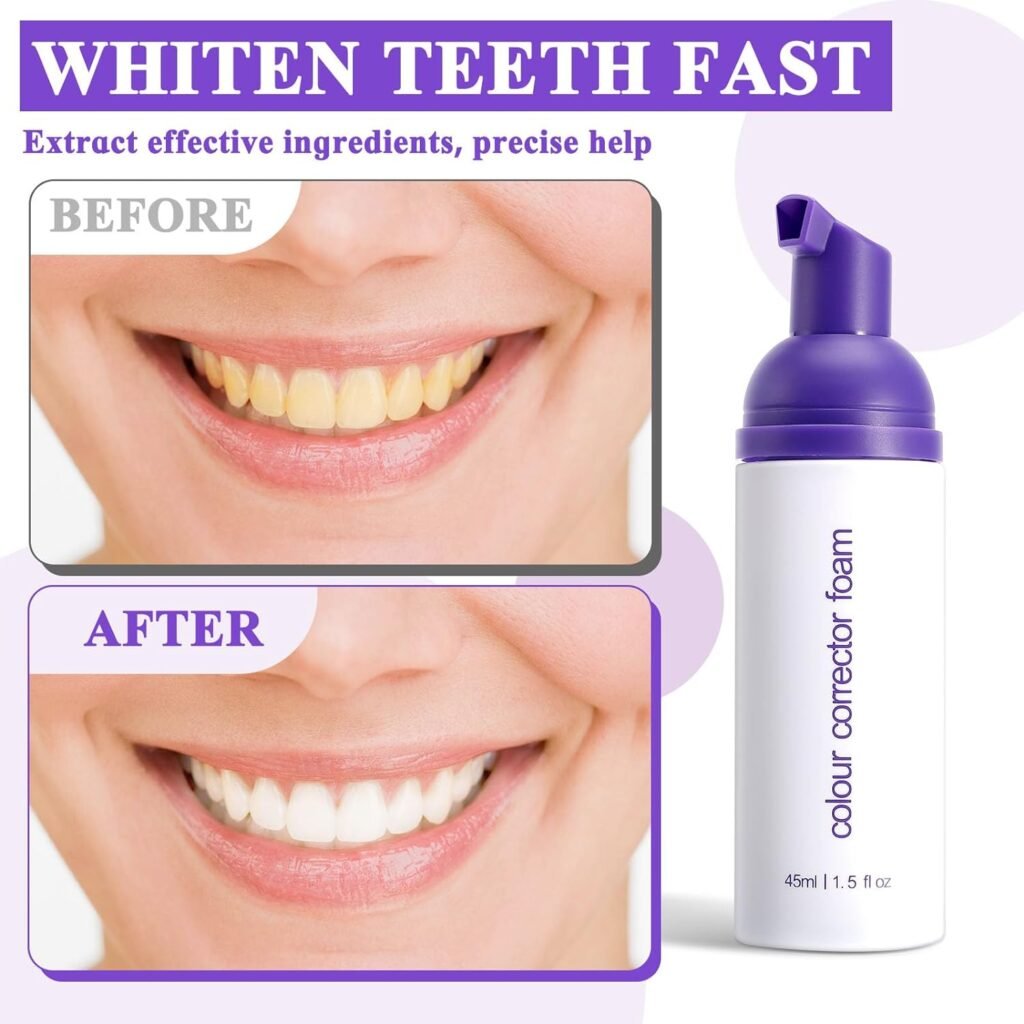 Purple Toothpaste for Teeth Whitening, Purple Toothpaste Whitening, Purple Teeth Whitening, Tooth Stain Removal, Purple Toothpaste