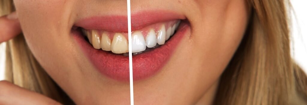 Maintaining Optimal Gum Health